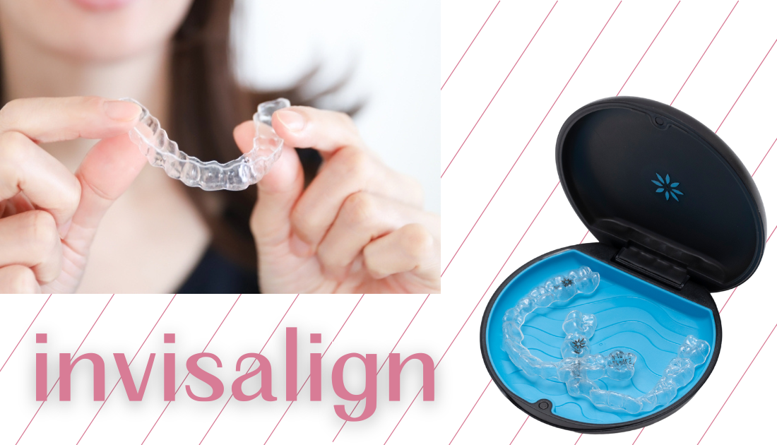 invisalign