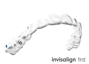 インビザラインファースト