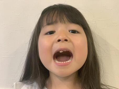 口を開けている子供