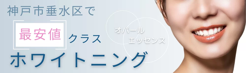 ホワイトニングバナー