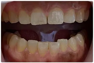 Before Image