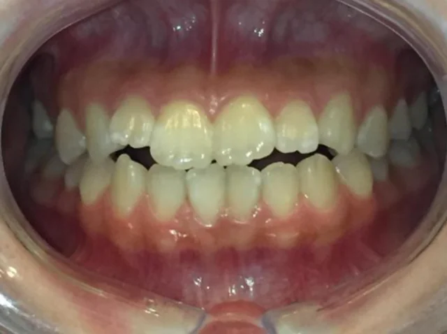 Before Image