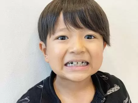 歯を見せる男の子