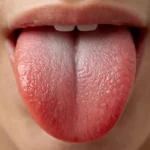 舌の正しい位置はどこ？